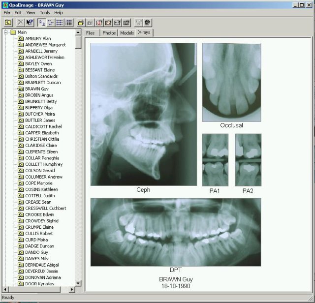 opal-xrays.jpg