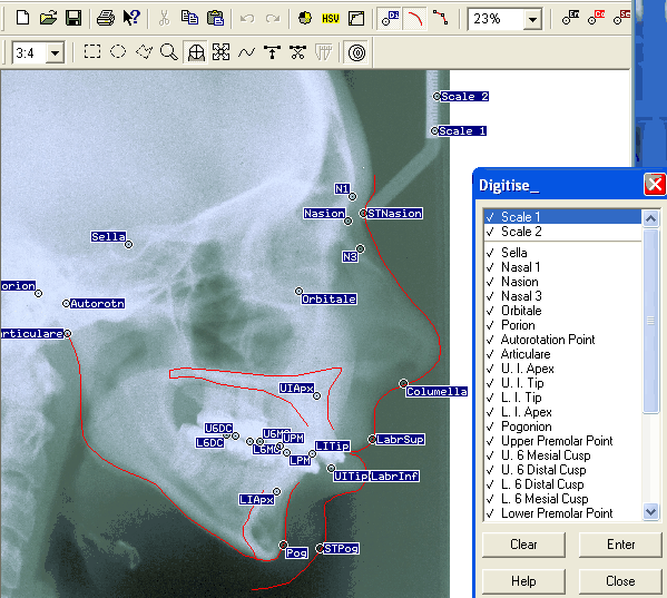 opalimg-onscreendig.gif