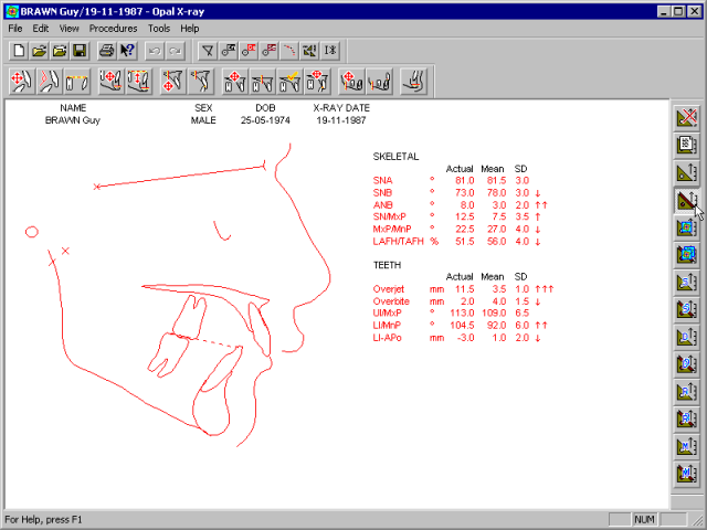 xray-analysis-eastman-means.gif