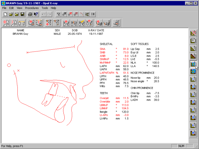 xray-analysis-opal.gif