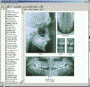 opal-xrays.gif