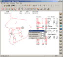 opaltrc-left-facing-surg.gif